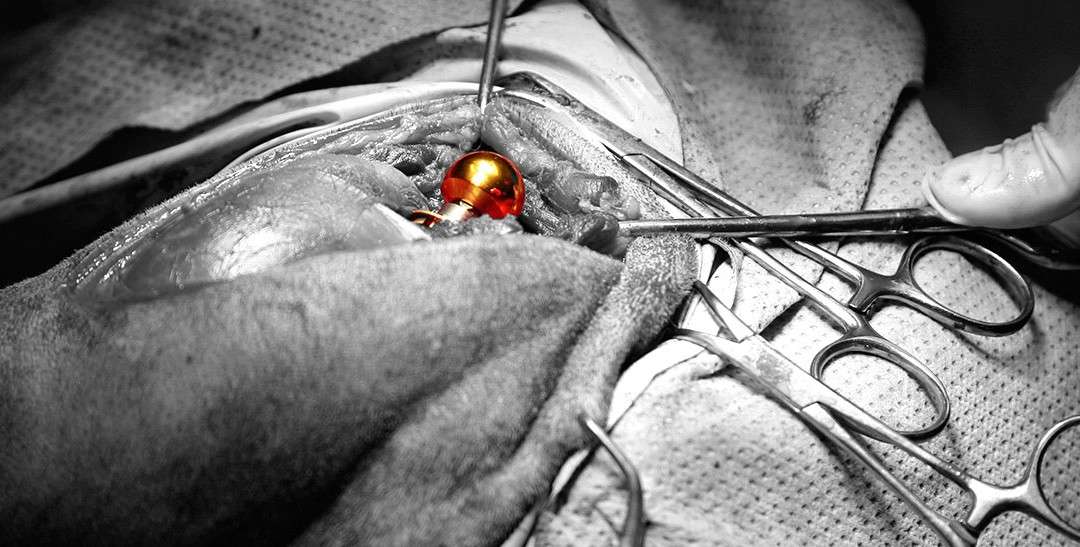 Chirurgie